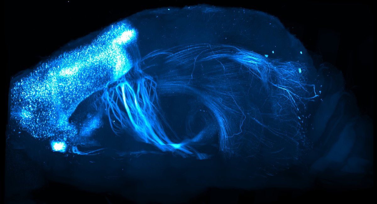 Rapid high-resolution mapping of projections across the entire brain.